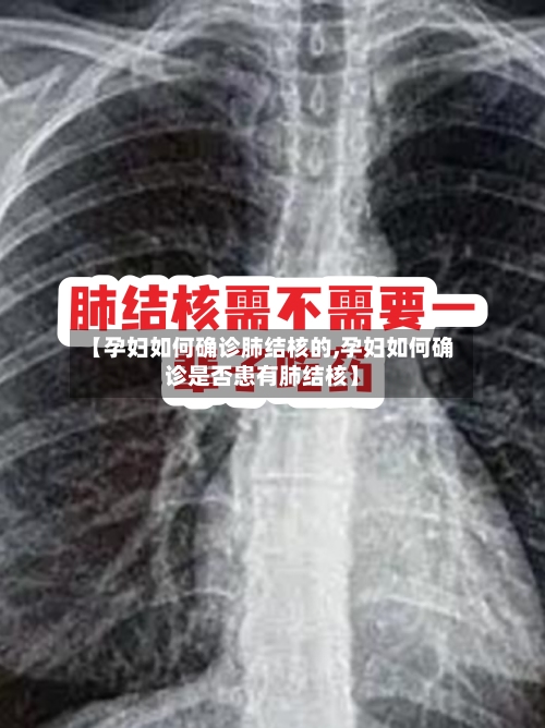 【孕妇如何确诊肺结核的,孕妇如何确诊是否患有肺结核】