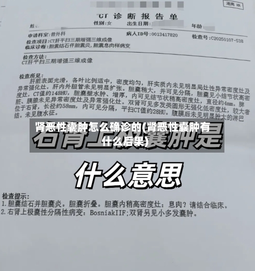 肾恶性囊肿怎么确诊的(肾恶性囊肿有什么后果)