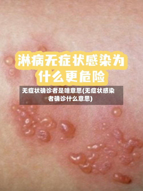 无症状确诊者是啥意思(无症状感染者确诊什么意思)-第2张图片