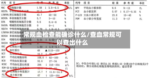 常规血检查能确诊什么/查血常规可以查出什么