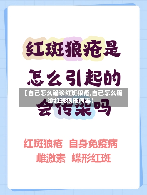 【自己怎么确诊红斑狼疮,自己怎么确诊红斑狼疮病毒】-第2张图片