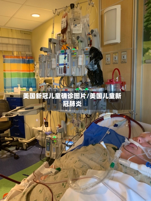 美国新冠儿童确诊图片/美国儿童新冠肺炎