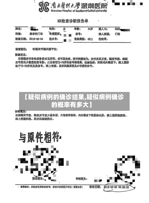 【疑似病例的确诊结果,疑似病例确诊的概率有多大】