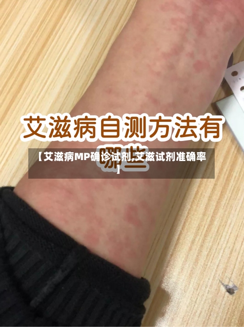 【艾滋病MP确诊试剂,艾滋试剂准确率】