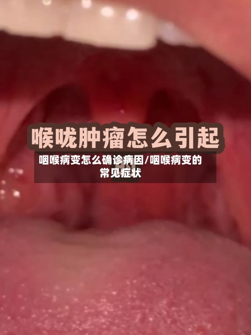 咽喉病变怎么确诊病因/咽喉病变的常见症状