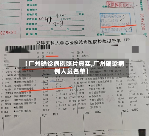 【广州确诊病例照片真实,广州确诊病例人员名单】