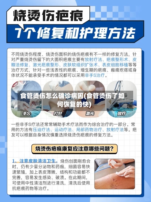 食管烫伤怎么确诊病因(食管烫伤了如何恢复的快)-第3张图片