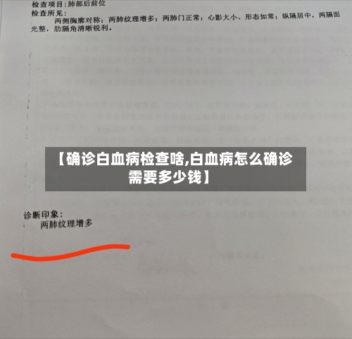 【确诊白血病检查啥,白血病怎么确诊需要多少钱】-第2张图片