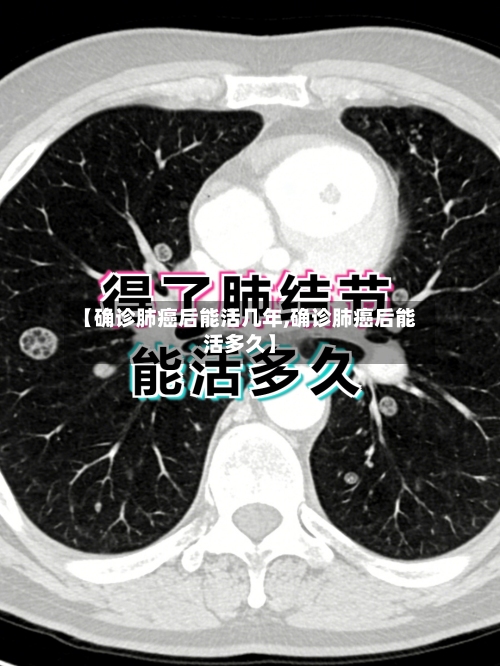 【确诊肺癌后能活几年,确诊肺癌后能活多久】-第3张图片