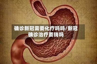 确诊新冠需要化疗吗吗/新冠确诊治疗要钱吗