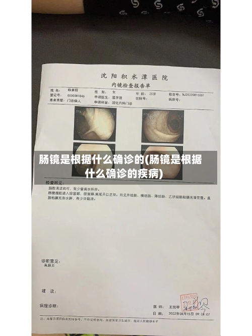 肠镜是根据什么确诊的(肠镜是根据什么确诊的疾病)