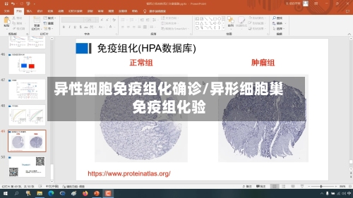 异性细胞免疫组化确诊/异形细胞巢免疫组化验