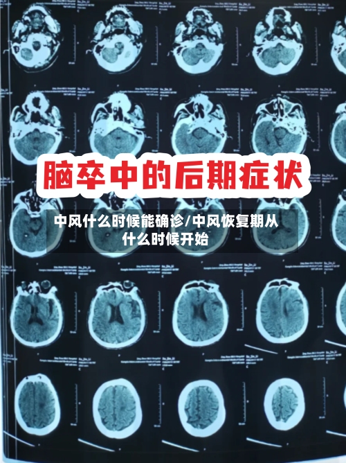 中风什么时候能确诊/中风恢复期从什么时候开始