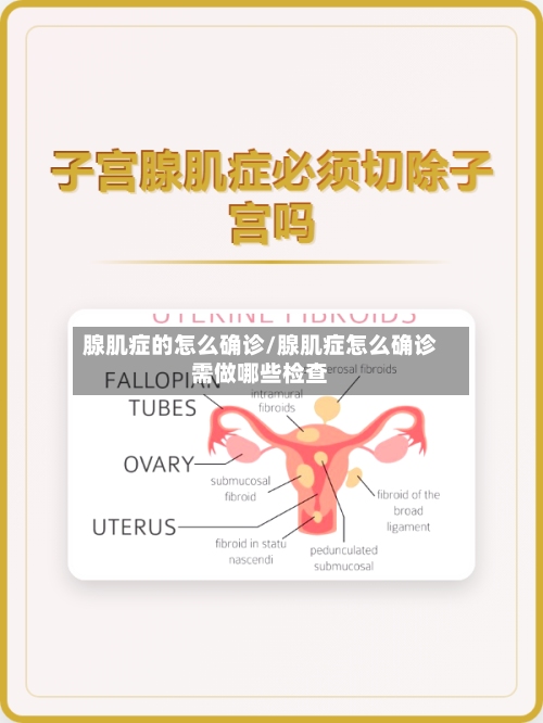 腺肌症的怎么确诊/腺肌症怎么确诊需做哪些检查-第2张图片