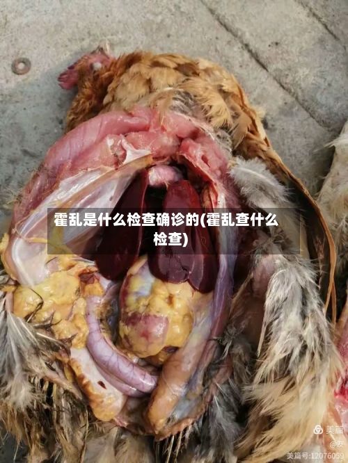 霍乱是什么检查确诊的(霍乱查什么检查)-第2张图片
